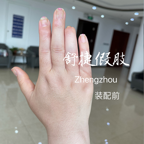 美容假手指裝配前